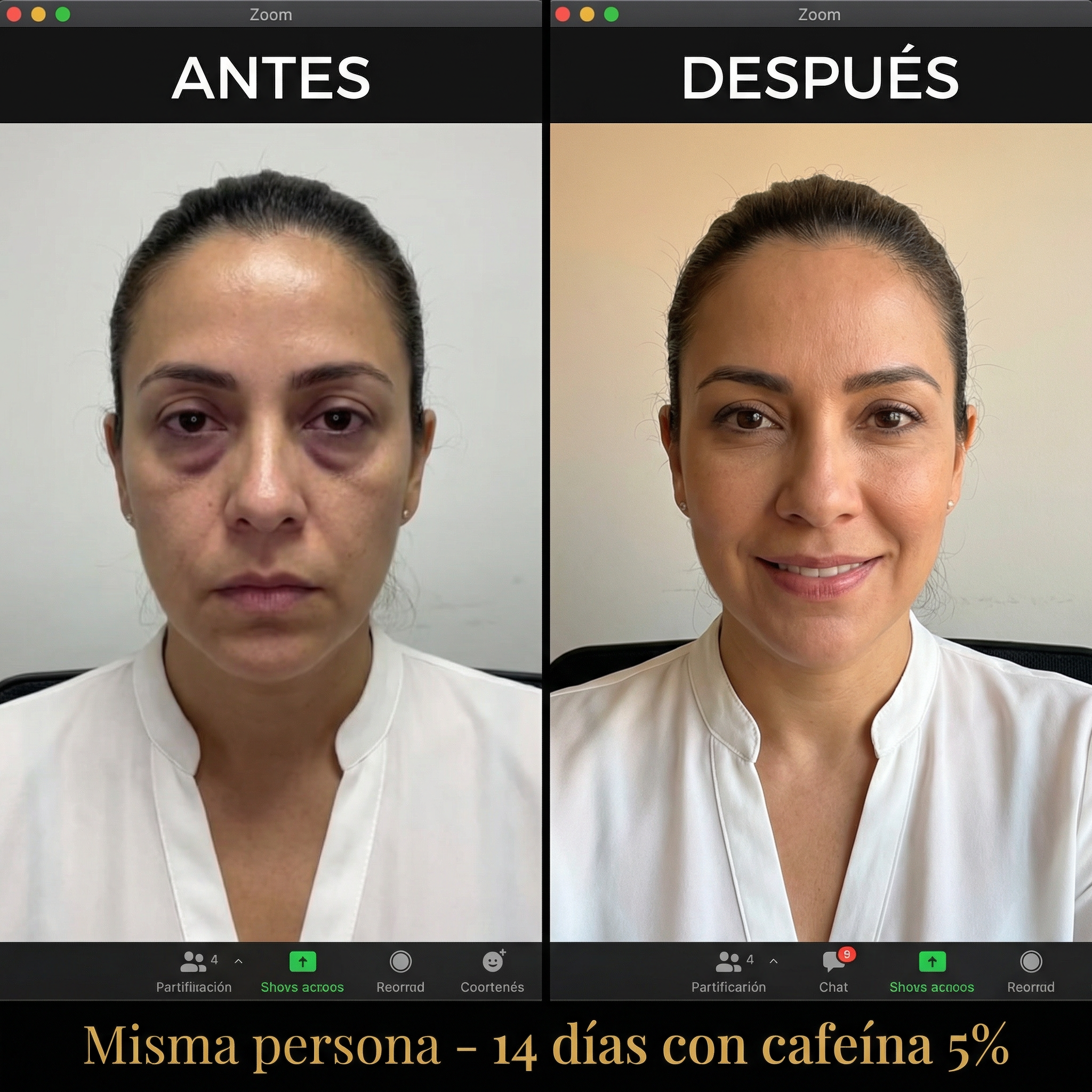 SERUM CAFEINA 5% – GEL CONTORNO DE OJOS A2